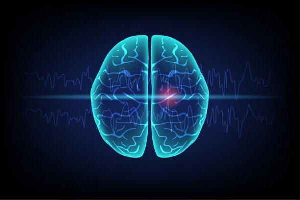 Seizure Treatment Surgery